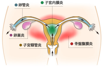 性病検査キットと病院の性病検査の違いは？ | 腟ペディア（チツペディア）