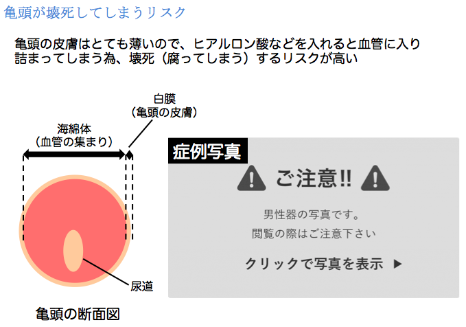 性教育」ネットで広がり 正しい知識を若者に：東京新聞デジタル