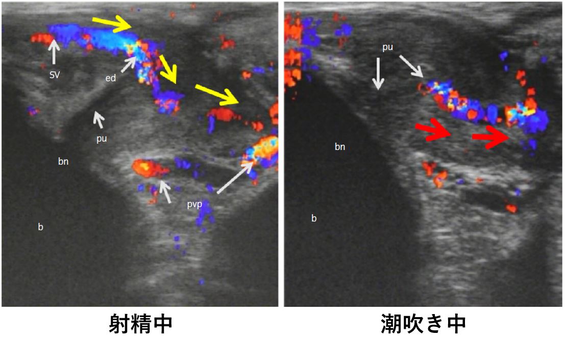 女性の「潮吹き」と「女性の射精」の明確の違いについて - 美容外科｜船橋中央クリニック&青山セレスクリニック