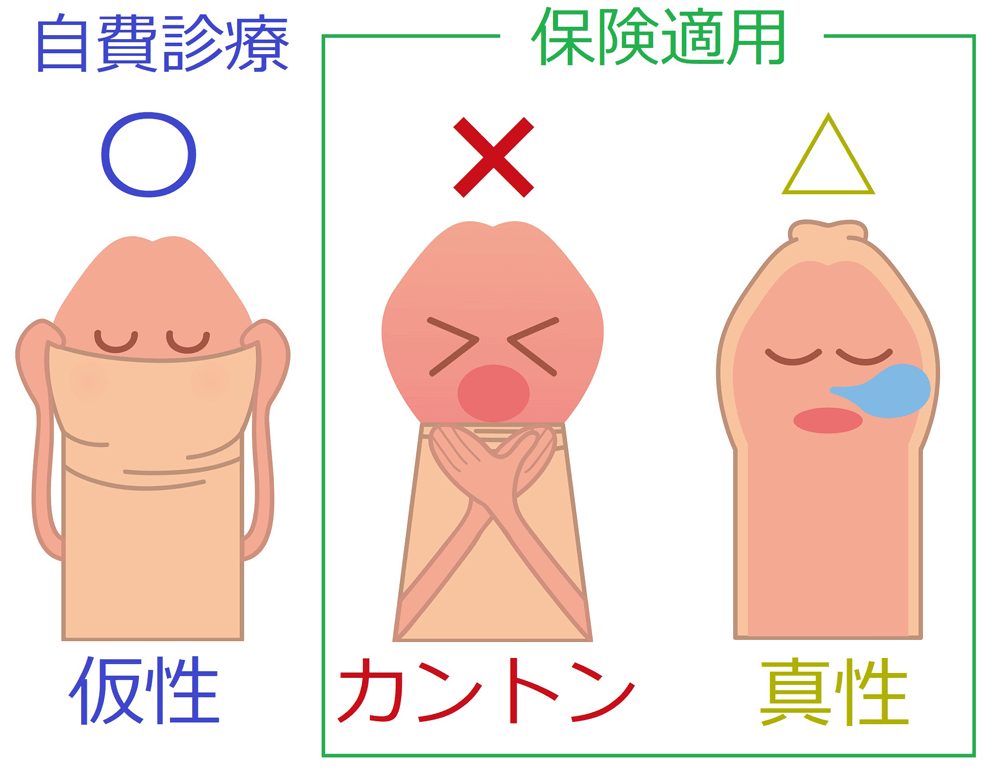 包茎とED（勃起不全）について｜【浜松町第一クリニック】