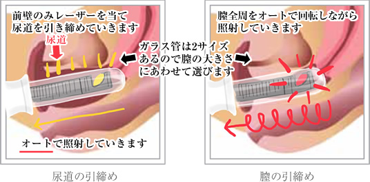 女性が感じる仕組みとは？オーガズムとスキーン腺の関係について解説 | コラム一覧｜ 東京の婦人科形成・小陰唇縮小・婦人科形成（女性器形成）・包茎手術・膣