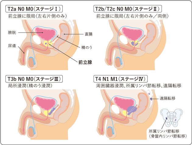 男性の“Gスポット”を探るための前立腺マッサージ4ステップ｜メンズヘルス公式