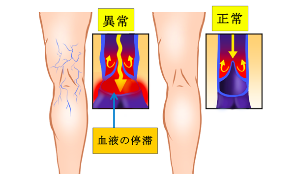 ふくらはぎをほぐす前に足裏ほぐすと簡単ですよ！