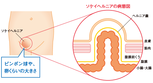 鼠径部 - 週刊エステコラム