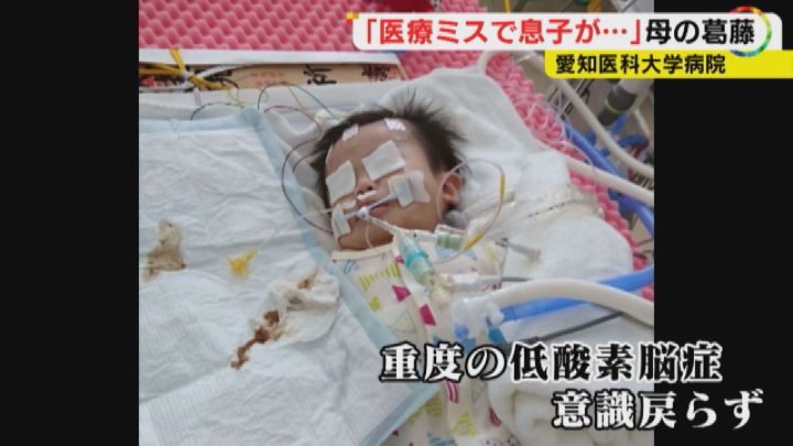 入院中「変わり果てた姿に…」7か月の我が子が突然意識不明に「医療ミスが原因」時効迫り提訴した母の苦悩 | 東海テレビNEWS