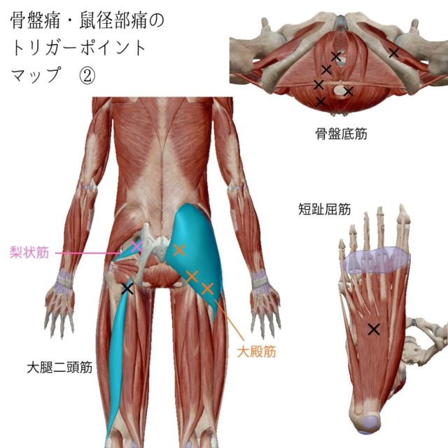 日帰り手術のご案内＞そけいヘルニアの手術について – 湘南中央病院