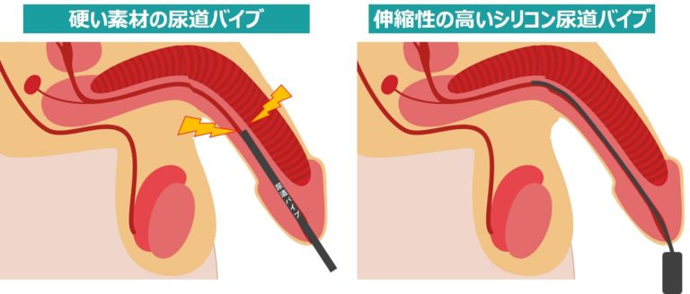 Honey Qp 命わずか 尿道オナニー配信者