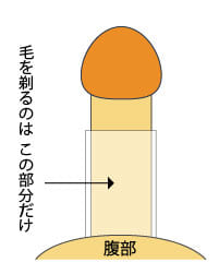 陰茎湾曲症の原因と手術について | 男性不妊治療は銀座リプロ外科