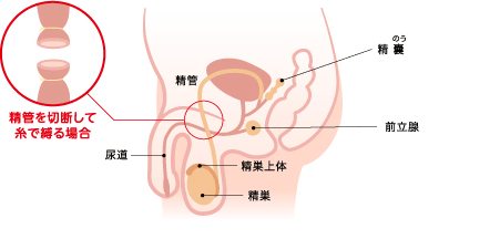 【外し方とその後も大事】コンドームの扱い方を深掘りしてみました！