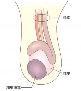 精液が真っ赤に―血精液症 一人悩まず、心配なら泌尿器科へ｜医療ニュース トピックス｜時事メディカル｜時事通信の医療ニュースサイト