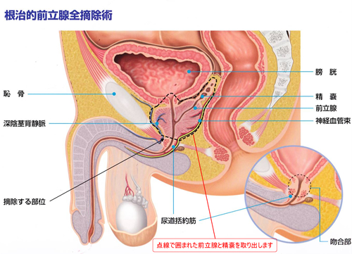 風俗】ソープとヘルスの違いとは？風俗嬢がわかりやすく解説｜パパ活プロデューサー