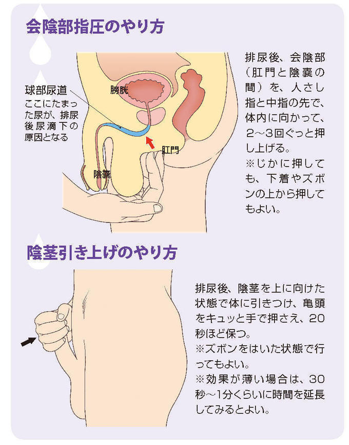 【尿道カテーテル】看護師が教えるバルーンカテーテルの挿入と固定方法！（女性編・男性編）