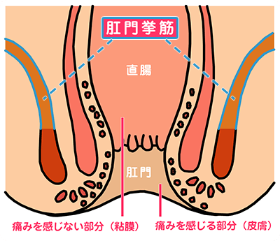 肛門周りの毛を処理するべき理由・処理方法と人気のOライン脱毛についても解説！ | メンズ脱毛百科事典 リンクスペディア