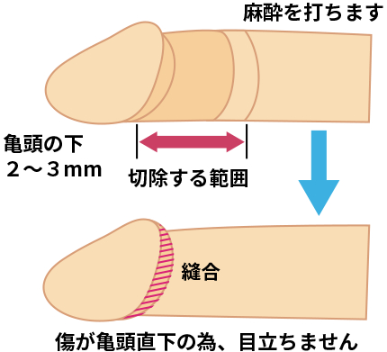 芳賀セブン＠レンタル遅刻するボディビルダー | 僕の筋トレ論に「細い幹に太い枝は生えない」と言うのがある  体幹部の筋肉がペラペラなのにその先にある肩や腕がデカくなる訳がないと