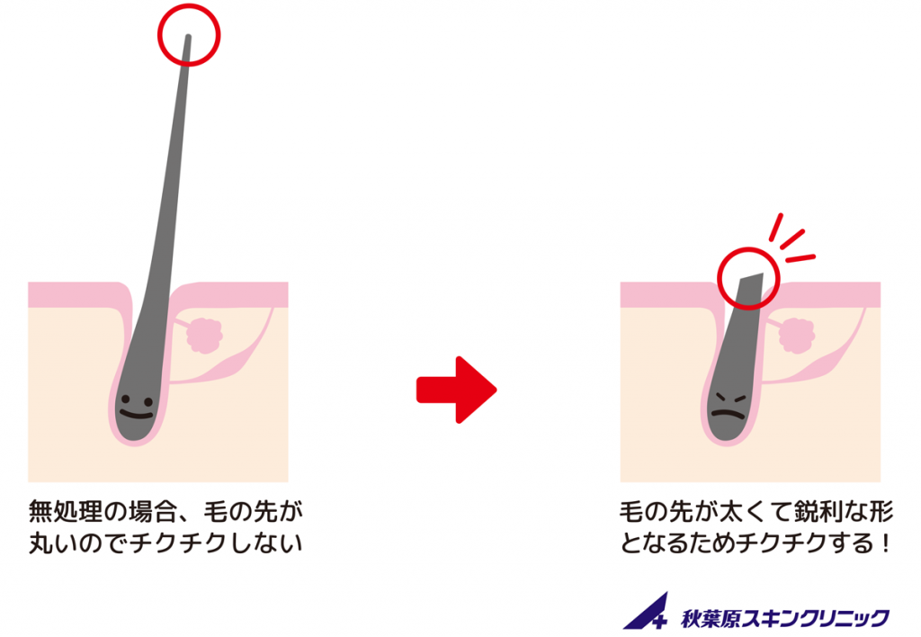 メンズの除毛方法はこれがおすすめ】これでチクチク肌とおさらば！ | DCOLLECTION×COSME