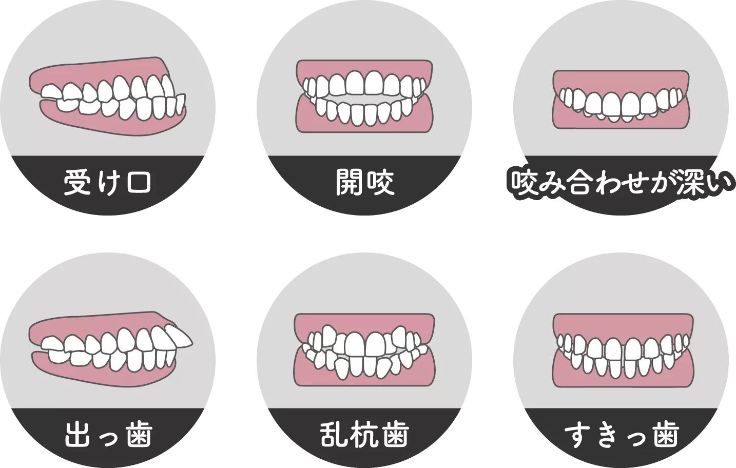 芸能人、有名人、スポーツ選手のガミースマイル（見えすぎる歯ぐき）まとめ - 本町の矯正・歯科 本町ノーブル歯科