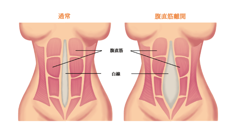 足（脚）の疾患／足の外科 - 池上整形外科