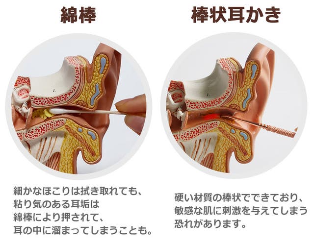 耳がかゆいと何故耳かきしてしまうのか？ -痛みとかゆみ –