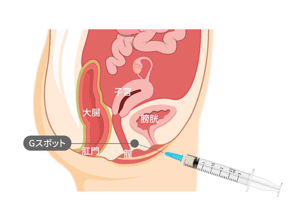 前立腺責めのやり方とコツ！気持ちいい前立腺マッサージの方法をイラストで解説