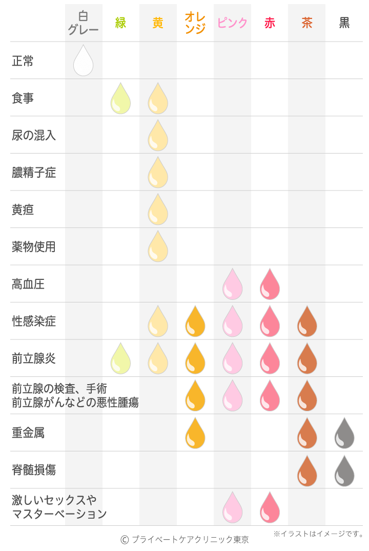 泌尿器科の専門医が徹底解説】早漏は手術で治療可能！効果・方法・費用・痛みなど