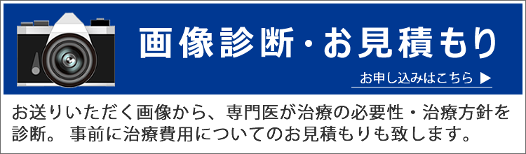 屈曲ペニスとは？曲がり方・原因・問題点・治し方を解説 | ザヘルプM