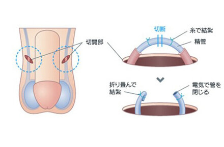 避妊相談 | 南部産婦人科医院