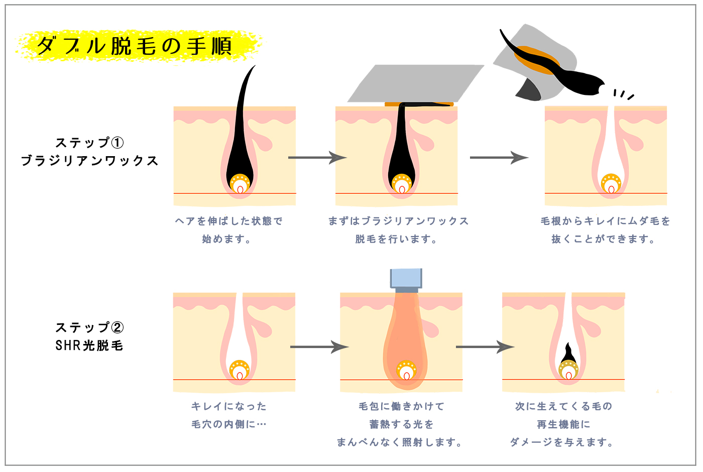 東京メンズブラジリアンワックス脱毛専門サロン Queen's Wax