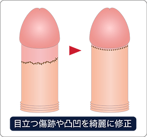 清潔に保つ方法 | SEXOLOGY