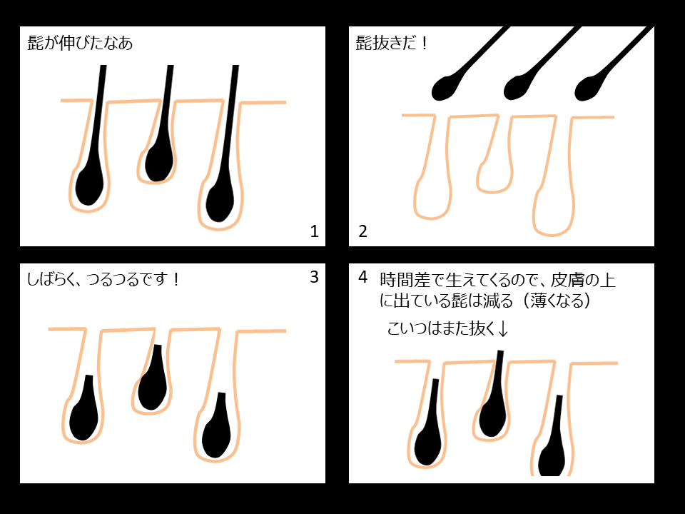 髭は抜いた方がいい説】髭を抜くメリットと致命的なデメリットとは？ - やってみたブログ