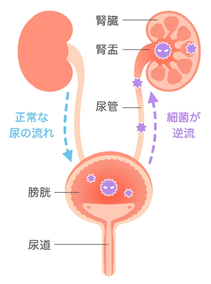 女性に多い】膀胱炎の原因から症状・治し方まで解説 | ひまわり医院（内科・皮膚科）