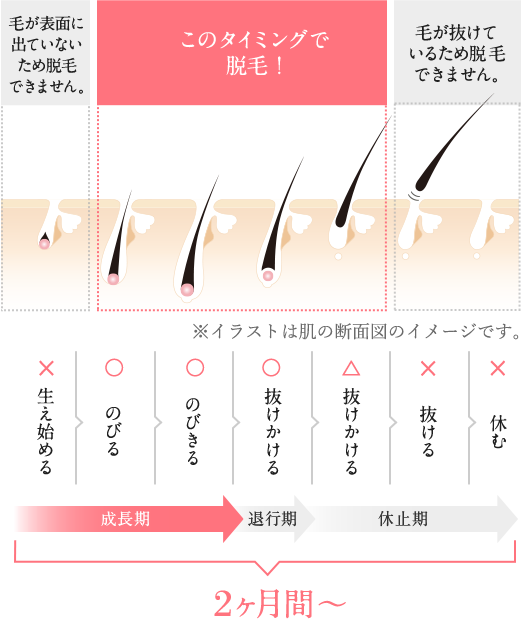 優待】 メンズTBC 脱毛体験チケット ヒゲ脱毛 カラダ脱毛